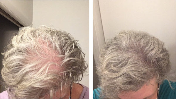 Caboki Hair Fiber, All-Natural Hair Loss Concealer (30 Gram, 90-day supply) **BEST SELLER**