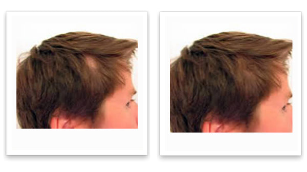 Caboki 10X Hair Powder - Enhances Hairline, Hair Volume, Root Touch Up. Talc-Free, Mica-Free.