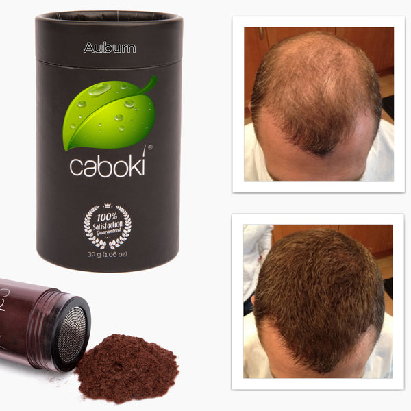 Caboki Hair Fiber, All-Natural Hair Loss Concealer (30 Gram, 90-day supply) **BEST SELLER**