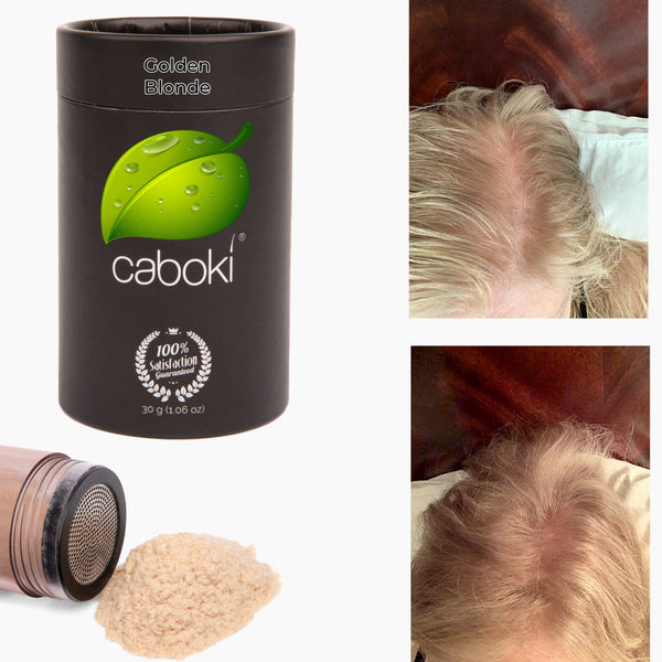 Caboki Hair Fiber, All-Natural Hair Loss Concealer (30 Gram, 90-day supply) **BEST SELLER**