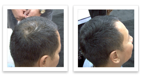 Before and after image of a man with short straight hair with thin hair on his crown