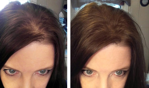 Before and after of a woman with long straight brown hair that is thinning along the parting line