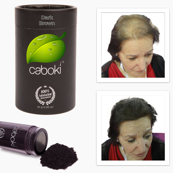 Caboki 30 Gram (90-day supply) **BEST SELLER**